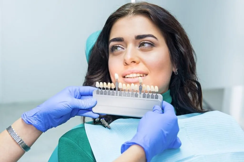 Faccette Dentali a Cagliari e Iglesias